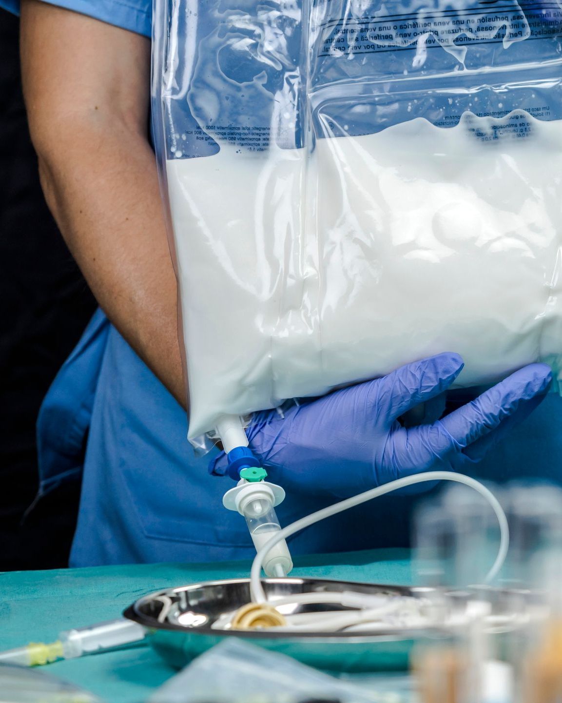 poche de nutrition parentérale pour les patients atteints de la maladie des inclusions microvillositaires (MVID)