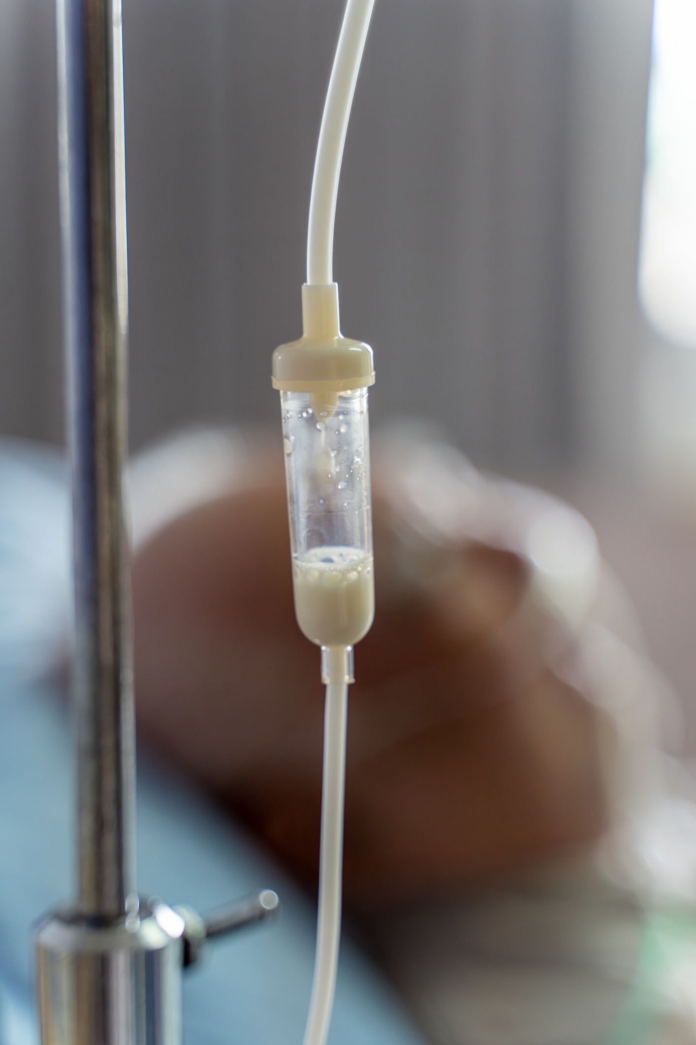 nutrition parentérale pour les patients atteints de la maladie des inclusions microvillositaires (MVID)