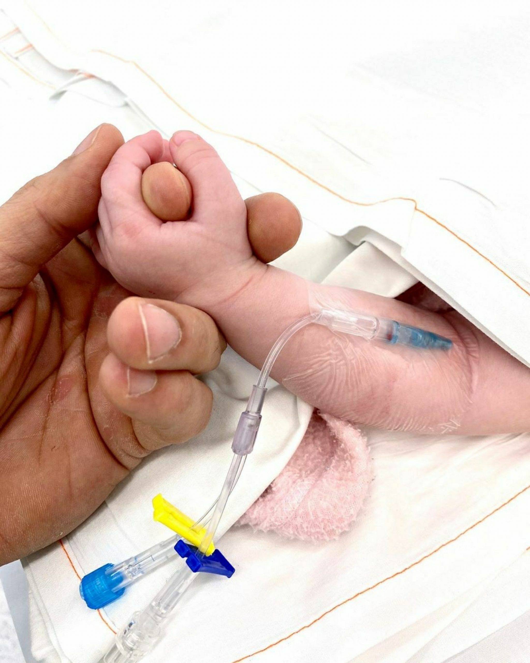 perfusion pour un patient atteint de MVID