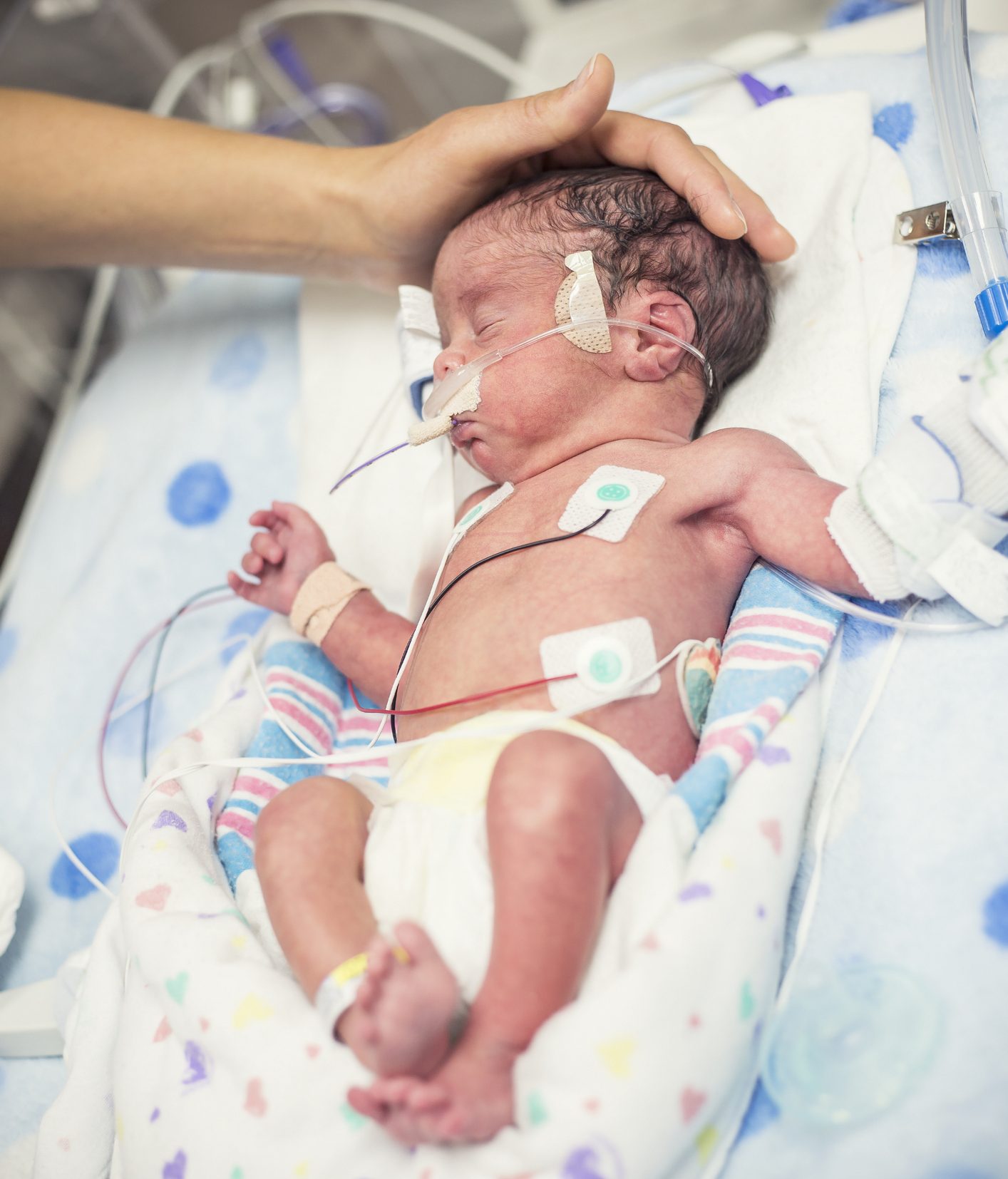 Mother touching her MVID newborn baby as he is hooked up to an IV and health monitors while being treated in intensive care